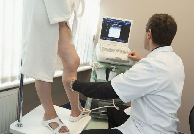 Diagnose von Krampfadern
